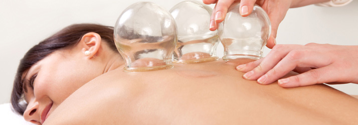 Massage Therapy The Woodlands TX Cupping Treatment